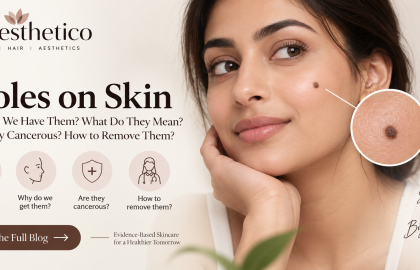 What Do Your Moles Really Mean?