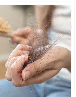 hair-fall